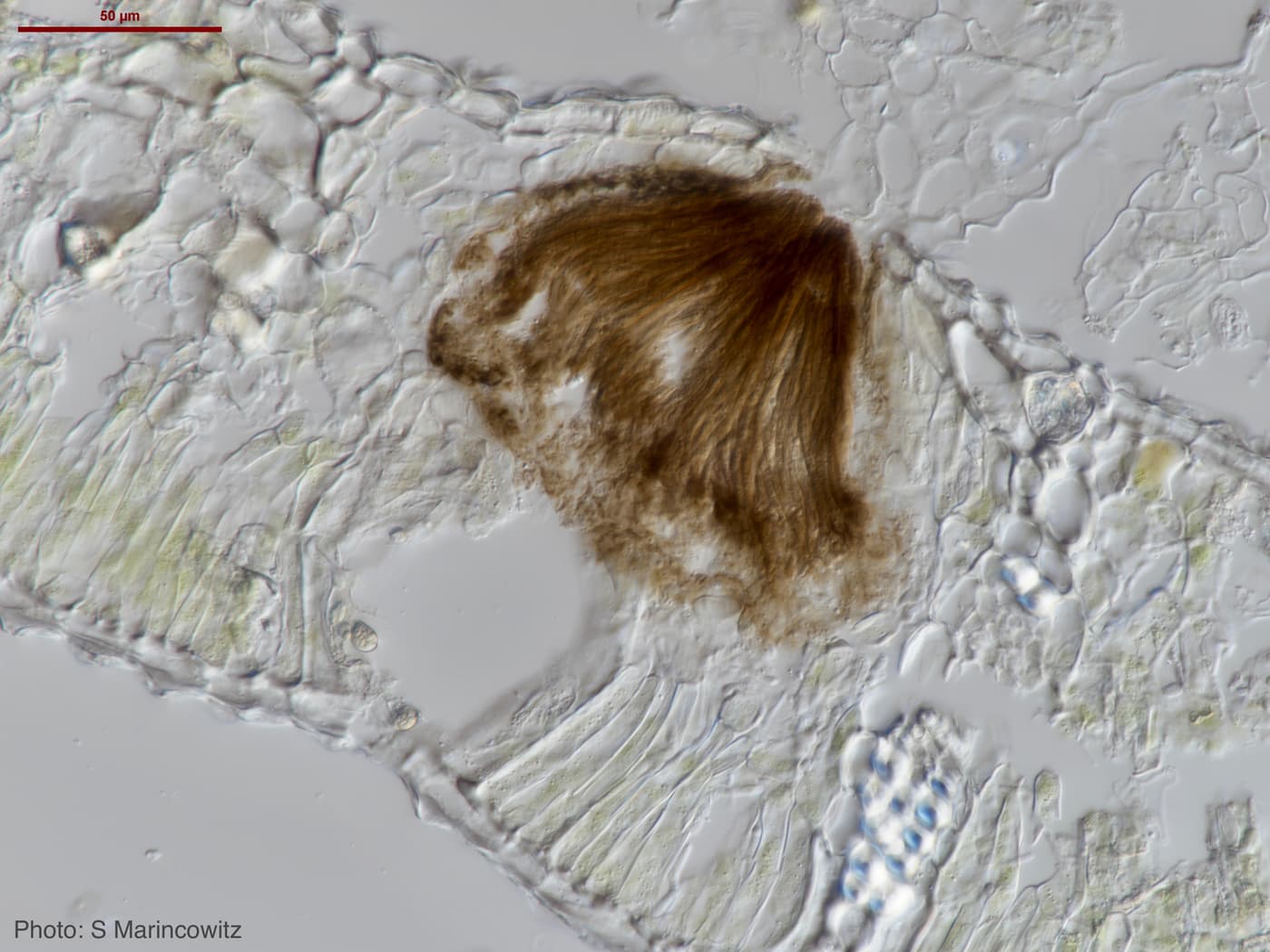 Teratosphaeria destructans pycnidium in the stomata of a Eucalyptus leaf