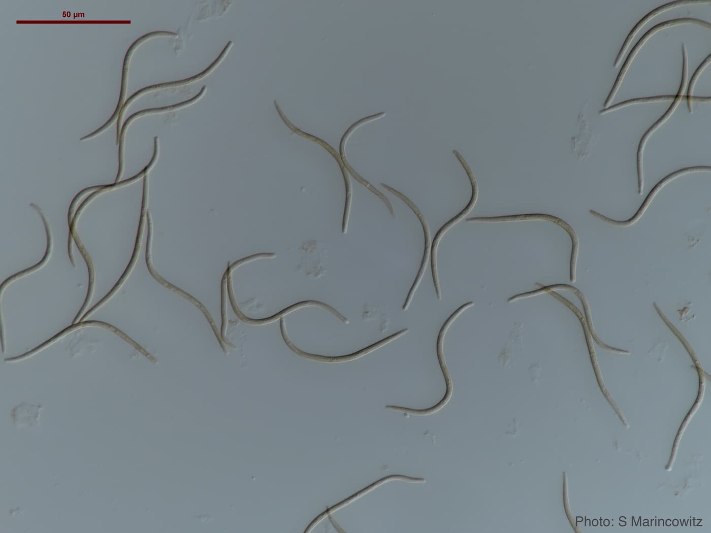 Conidia of Teratosphaeria destructans