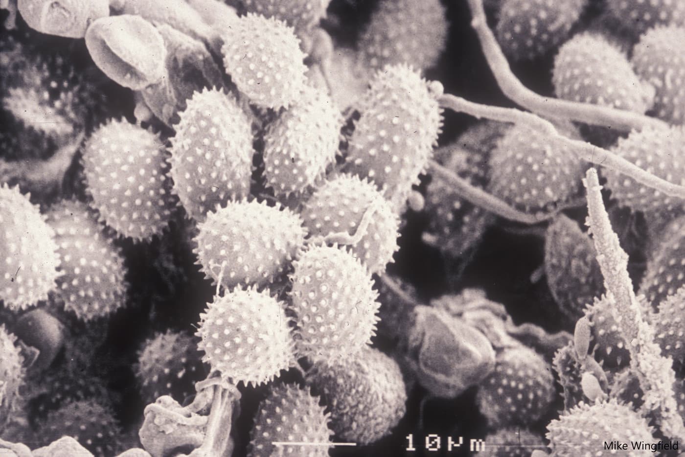 Urediniospores of Austropuccinia psidii