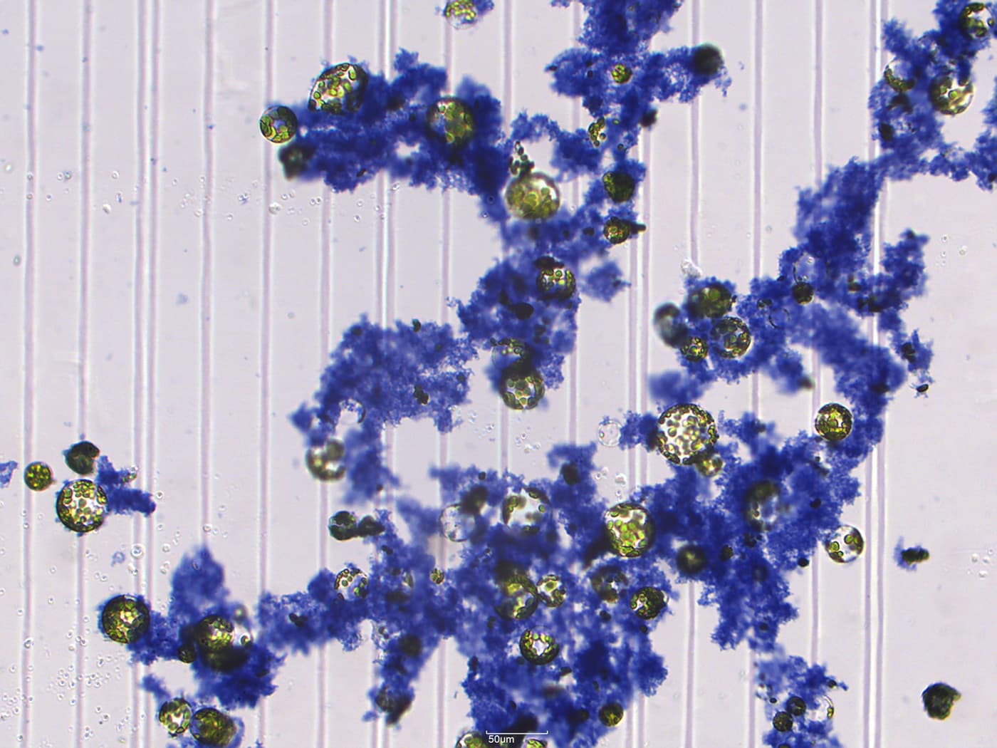 Arabidopsis protoplasts stained with Trypan blue